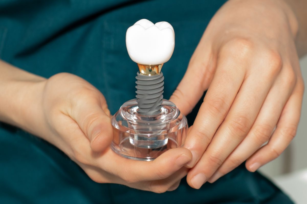 Dental Implants Richmond