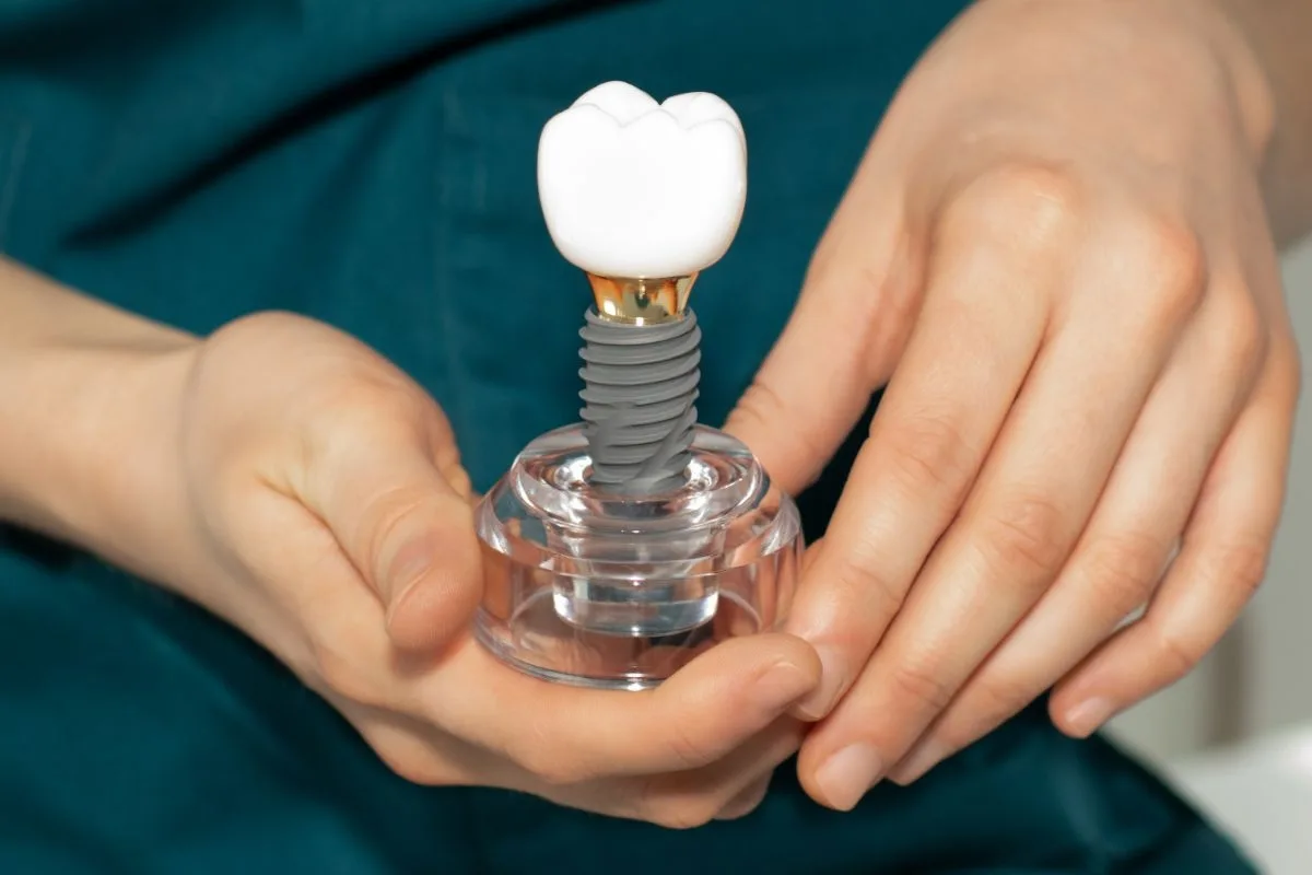 Dental Implants Richmond