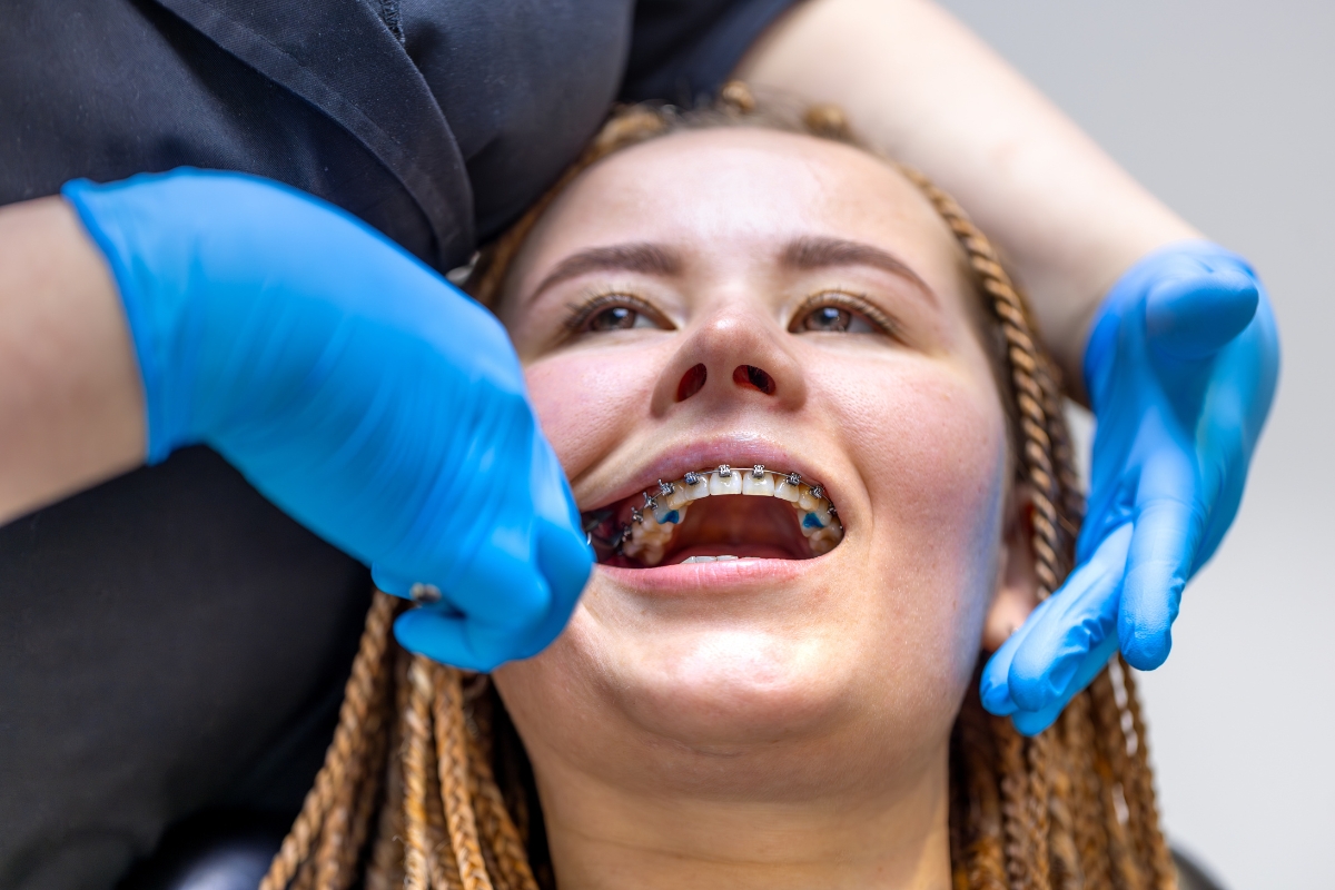 emergency dentist in Richmond
